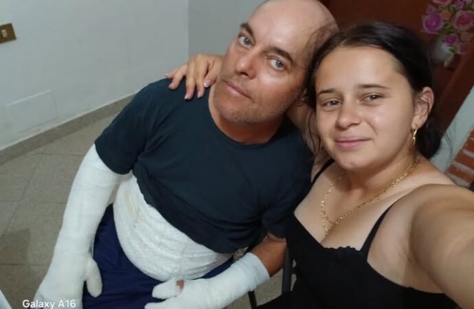 Ha rischiato di morire tra le fiamme, Alessandro Sacripanti sta meglio ed è fuori pericolo